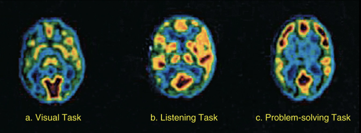 <p>Positron emission tomography (PET)</p>