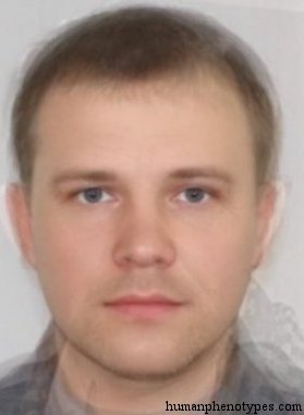 <p>Identify this Phenotype</p>