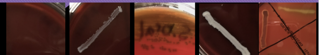<p>gram positive</p>
