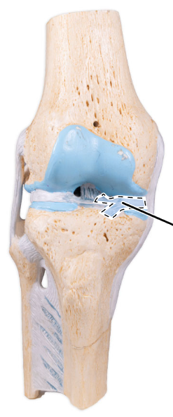 <p>What is the highlighted fibrocartilage?</p>