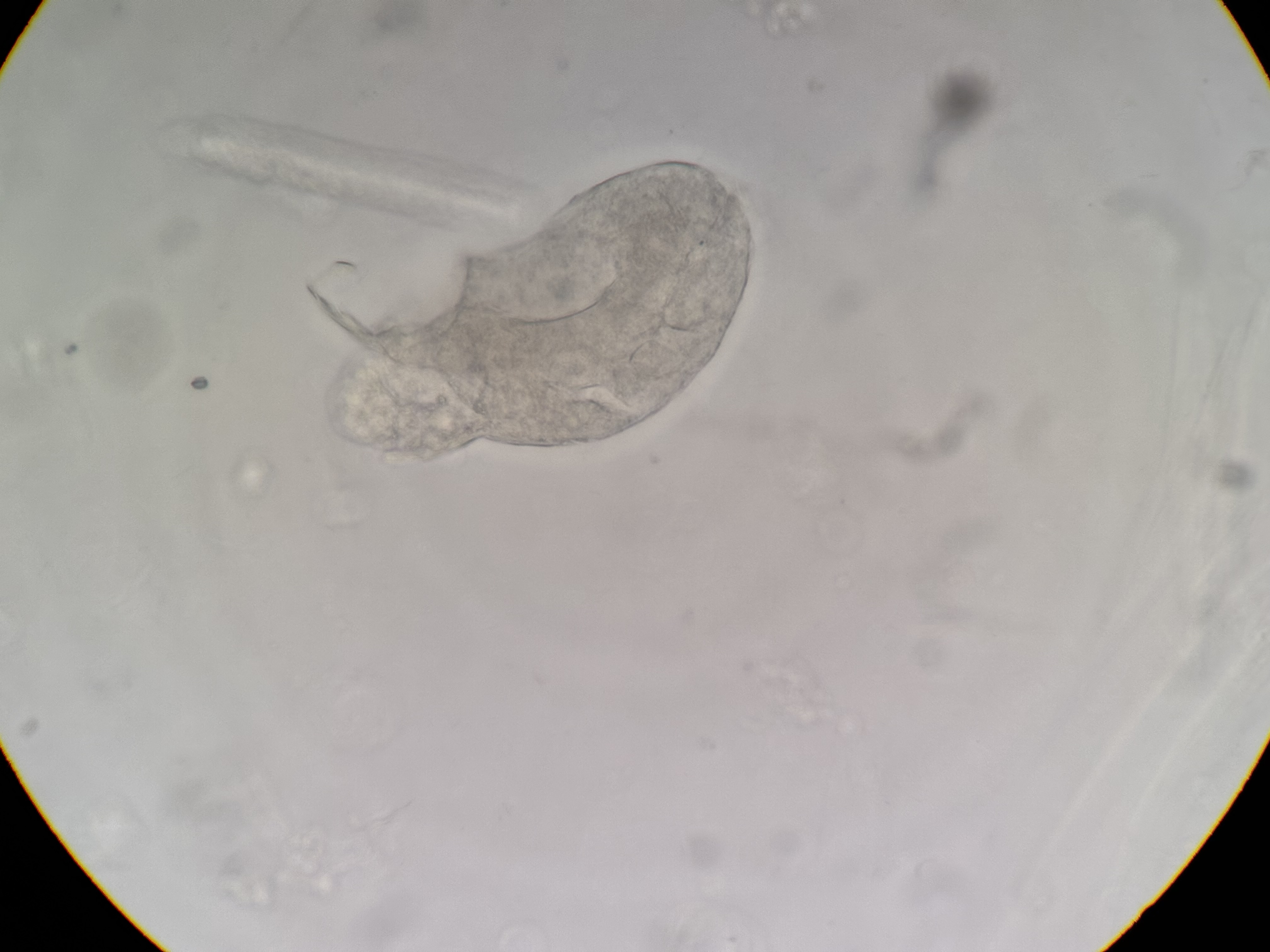 <p>Enterobius vermicularis (egg)</p>