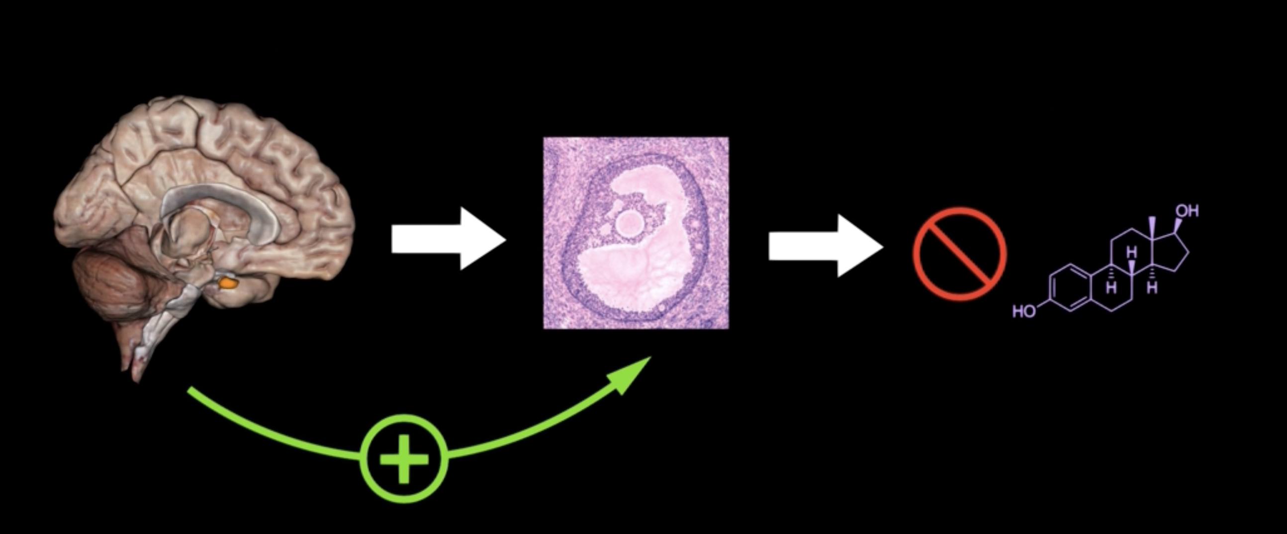<p>The anterior pituitary gland stimulates the follicles with [green']</p>