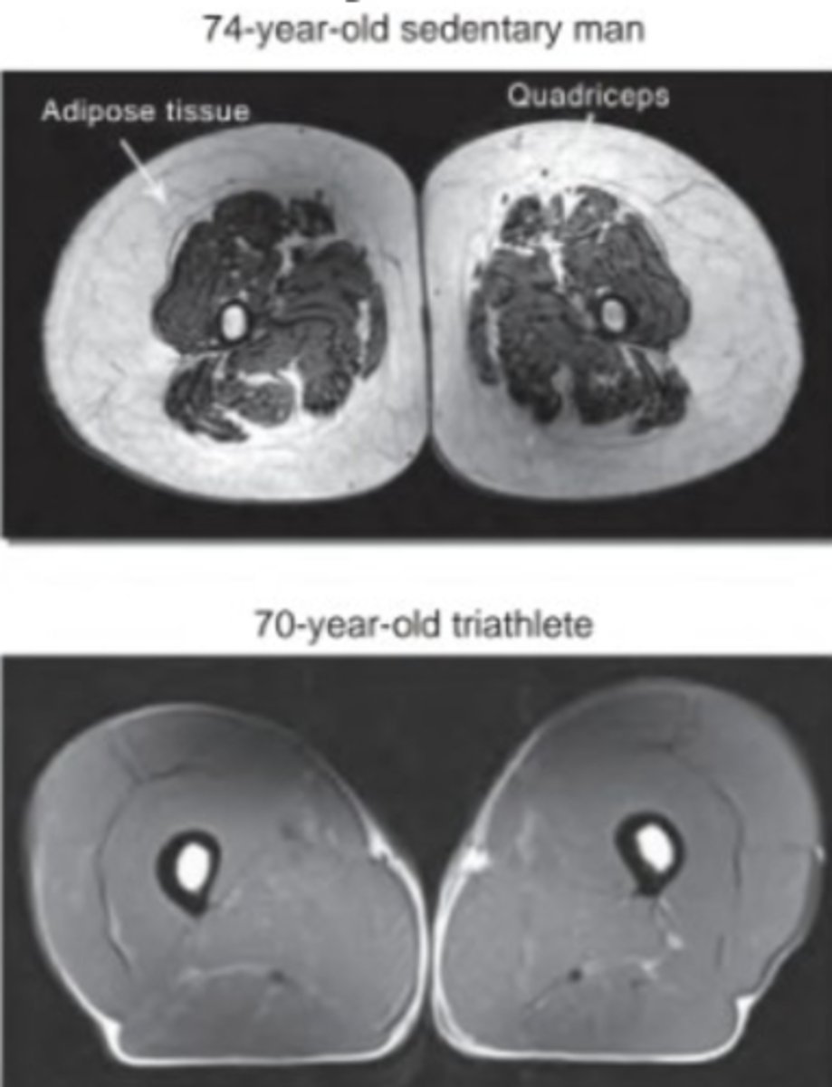 <p>White = Increased Fat Deposits</p>