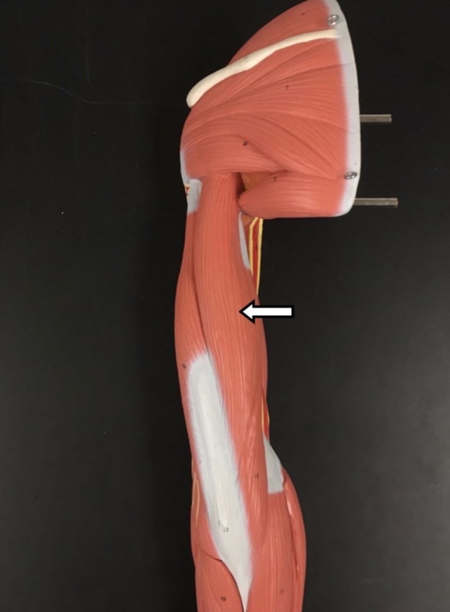 <p><span>Name the muscle labeled with the white arrow below - be specific! - AND name the origin .</span></p>