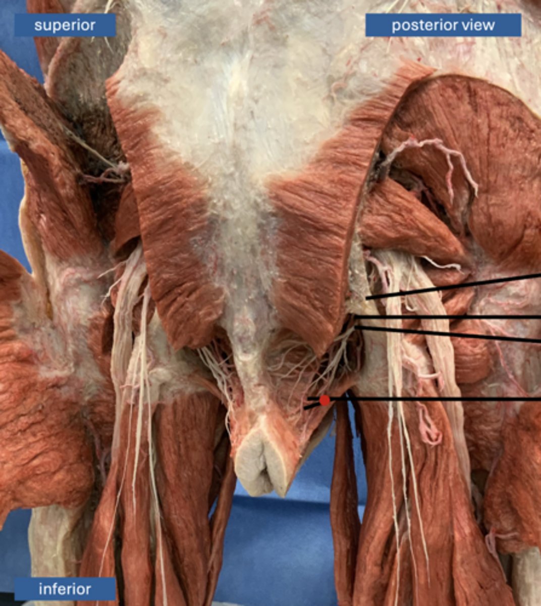 <p>artery</p>