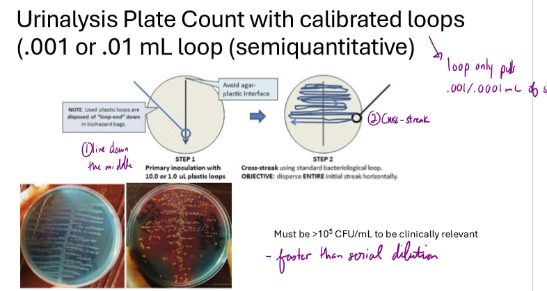 <p>What is a urinalysis plate count?</p>