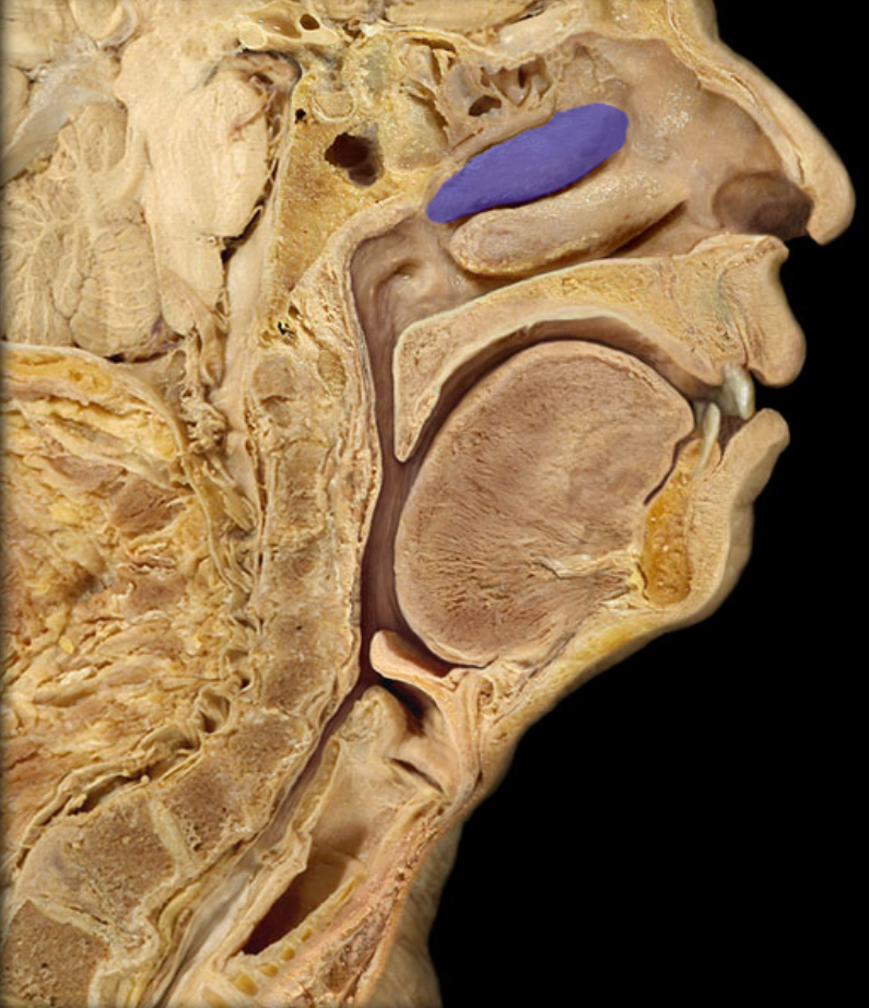 <p>This is one of three what?</p>