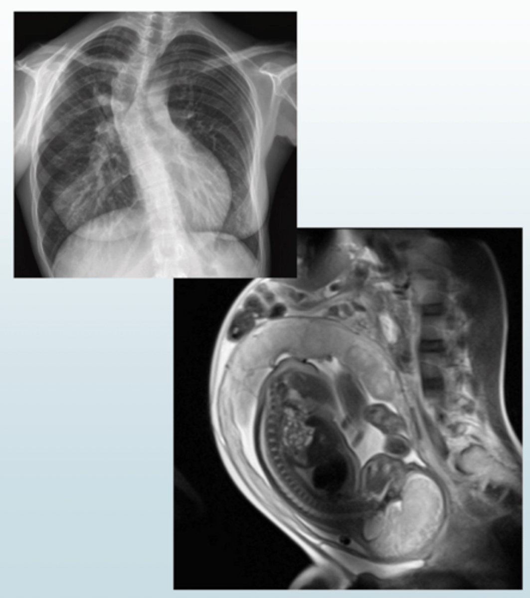 <p>Extrinsic; Restrictive</p>