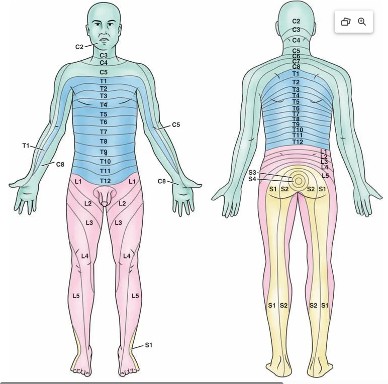 <ul><li><p><strong>Arise from:</strong> Spinal cord → innervate rest of body.</p></li><li><p><strong>Composition:</strong><br>• <strong>Afferent (sensory)</strong> fibers → dorsal root.<br>• <strong>Efferent (motor)</strong> fibers → ventral root.<br>• Combined = <strong>spinal nerve</strong>.</p></li><li><p><strong>Total:</strong> 31 pairs<br>• 8 <strong>Cervical (C1–C8)</strong><br>• 12 <strong>Thoracic (T1–T12)</strong><br>• 5 <strong>Lumbar (L1–L5)</strong><br>• 5 <strong>Sacral (S1–S5)</strong><br>• 1 <strong>Coccygeal</strong></p></li><li><p><strong>Dermatome:</strong> Skin area innervated by sensory fibers of a single spinal nerve.</p><ul><li><p>Level of injury to the spinal cord affects function at and below the site of trauma</p><ul><li><p><span><span>C1-C3: issues with movement of below neck</span></span><span style="line-height: 0px;"><span></span></span></p><p class="Paragraph WhiteSpaceCollapse SCXP171465584 BCX0" style="text-align: left;"><span><span>C4-C6: shoulder & diaphragm; Breathing</span></span><span style="line-height: 0px;"><span></span></span></p><p class="Paragraph WhiteSpaceCollapse SCXP171465584 BCX0" style="text-align: left;"><span><span>C7-C8: fingers & grasping, self care</span></span><span style="line-height: 0px;"><span></span></span></p><p class="Paragraph WhiteSpaceCollapse SCXP171465584 BCX0" style="text-align: left;"><span><span>T1-5: Trunk stability</span></span><br><span><span>T6-12: thoracic muscle & upper back → respiratory & transfer strength</span></span><span style="line-height: 0px;"><span></span></span></p><p class="Paragraph WhiteSpaceCollapse SCXP171465584 BCX0" style="text-align: left;"><span><span>L1-2: Legs & Pelvis</span></span><span style="line-height: 0px;"><span></span></span></p><p class="Paragraph WhiteSpaceCollapse SCXP171465584 BCX0" style="text-align: left;"><span><span>L3-L4: Ankle, hamstring</span></span></p></li></ul></li></ul></li><li><p><strong>Function:</strong> Each level controls motor & sensory activity for specific body regions (head → toe).</p></li></ul><p></p>