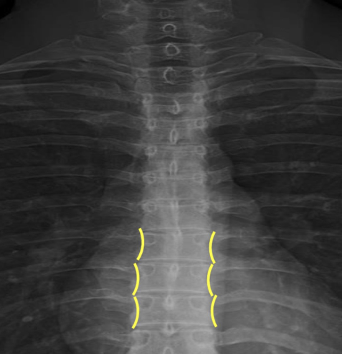<p>What is outlined in yellow?</p>