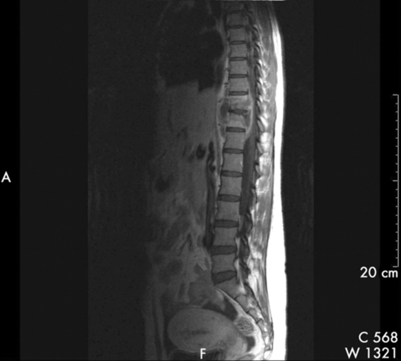 <p>T or F: This is normal anatomy</p>