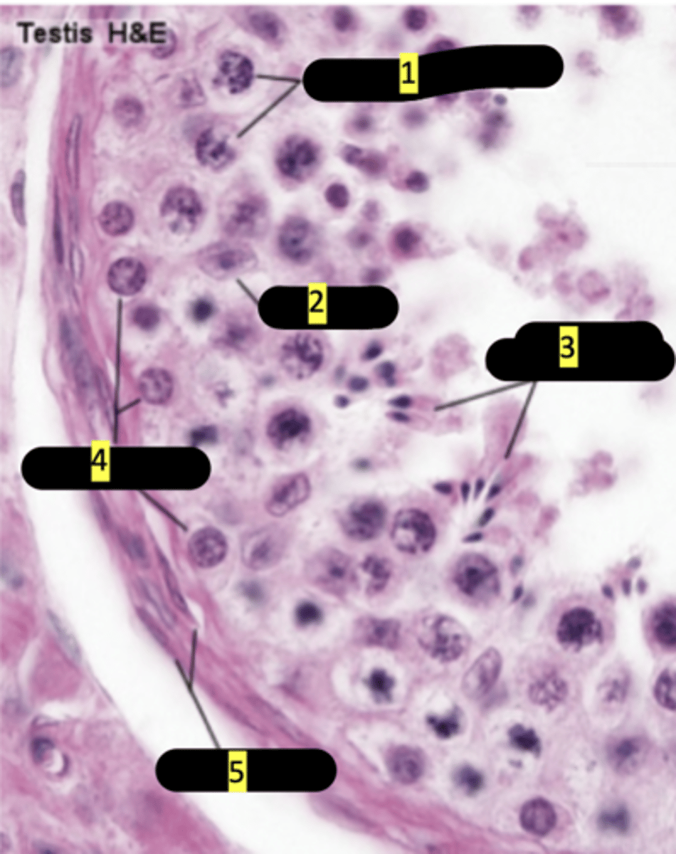 <p>#5</p>