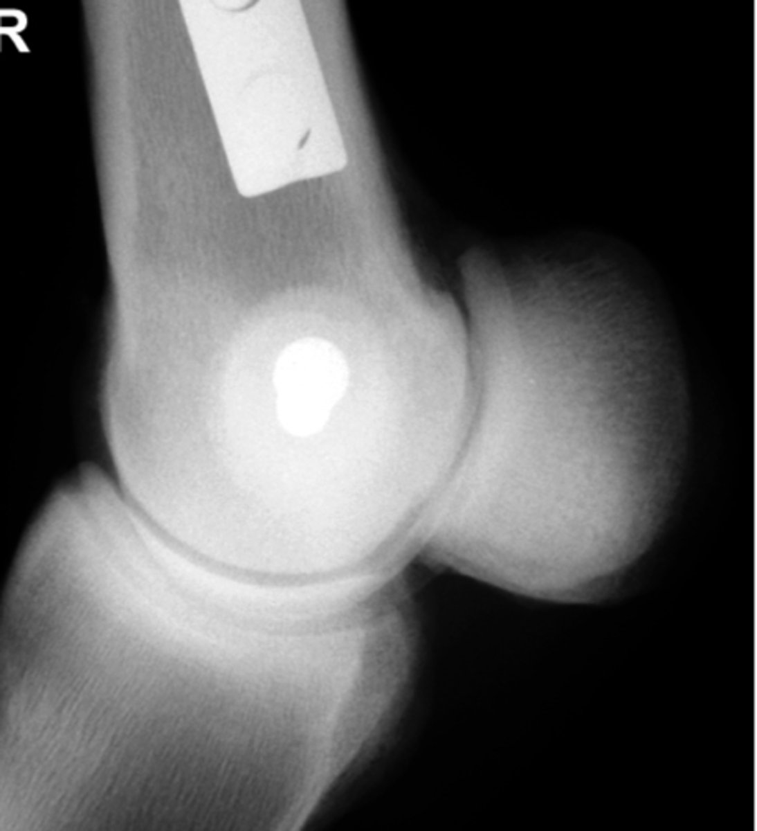 <p>Identify the pathology?</p>