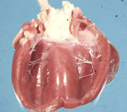 <p>Which type of cardiomyopathy is due to idiopathic causes, and can be hypertrophic, dilatative/congestive, or restrictive? It leads to arrhythmogenic right ventricular CMP, thickening of walls, can lead to saddle thrombi after formation of emboli in the left atrium in cats, leads to formation of moderator bands in the left side of the heart in cats (false tendons), and leads to pulmonary congestion, edema, ascites, hydrothorax, hepatic congestion, thromboemboli, and poikilothermy.</p>