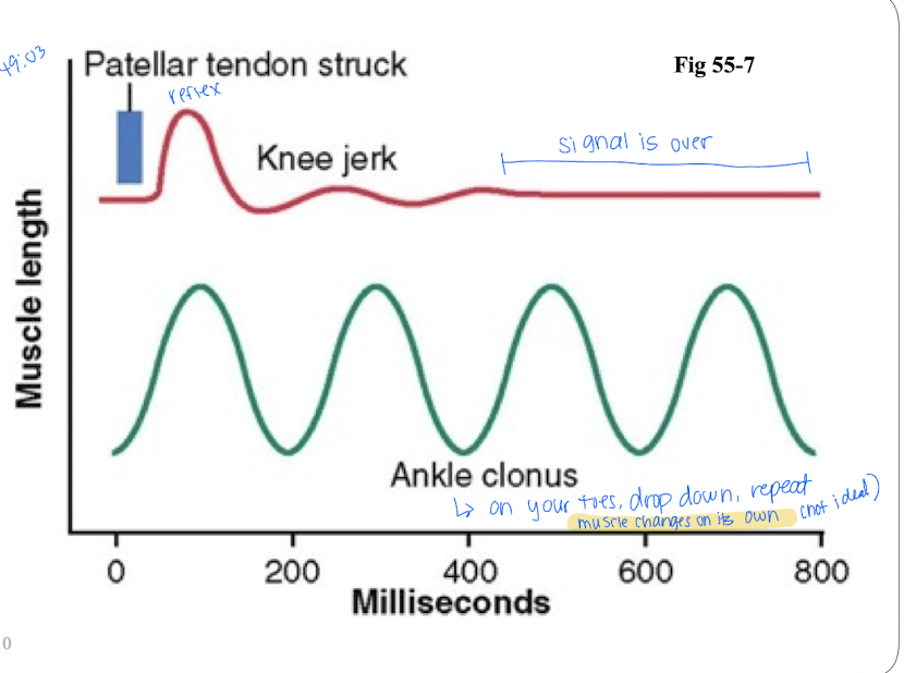 <p>Stretches quad muscle and excites a dynamic stretch reflex; used to asses the degree of facilitation of spinal cord centers.</p>
