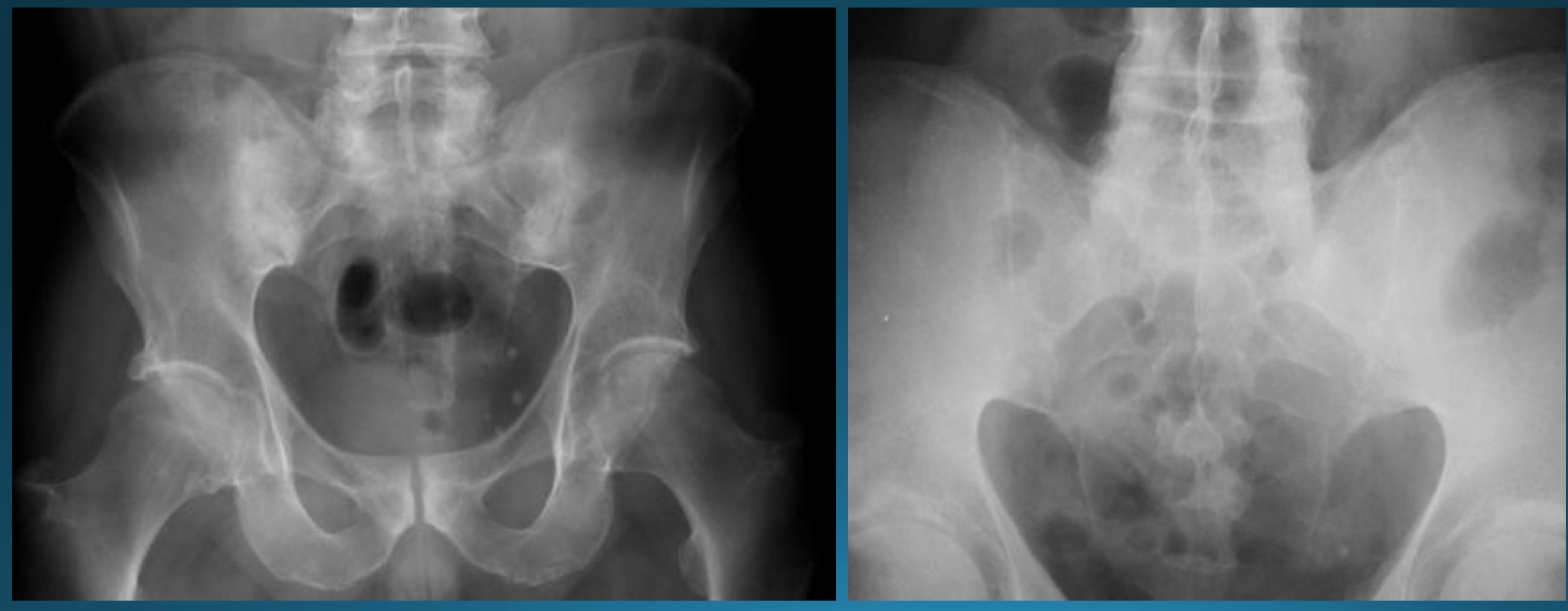 <p>what are the signs seen in this image? what diagnosis would you make? </p>