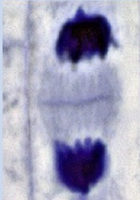 <p>Name this Mitosis Phase (Onion Root)</p>