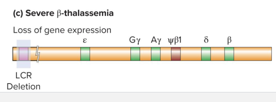 <ul><li><p>Can occur via deletions of various B-globins however</p></li><li><p>Severe B-thalassemia occurs when LCR is deleted</p><ul><li><p>Silences all B-globin genes even if all other regulatory sequences are preserved</p></li></ul></li></ul><p></p>