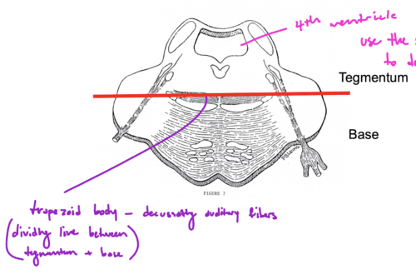 <p>trapezoid body -- decussating auditory fibers</p>