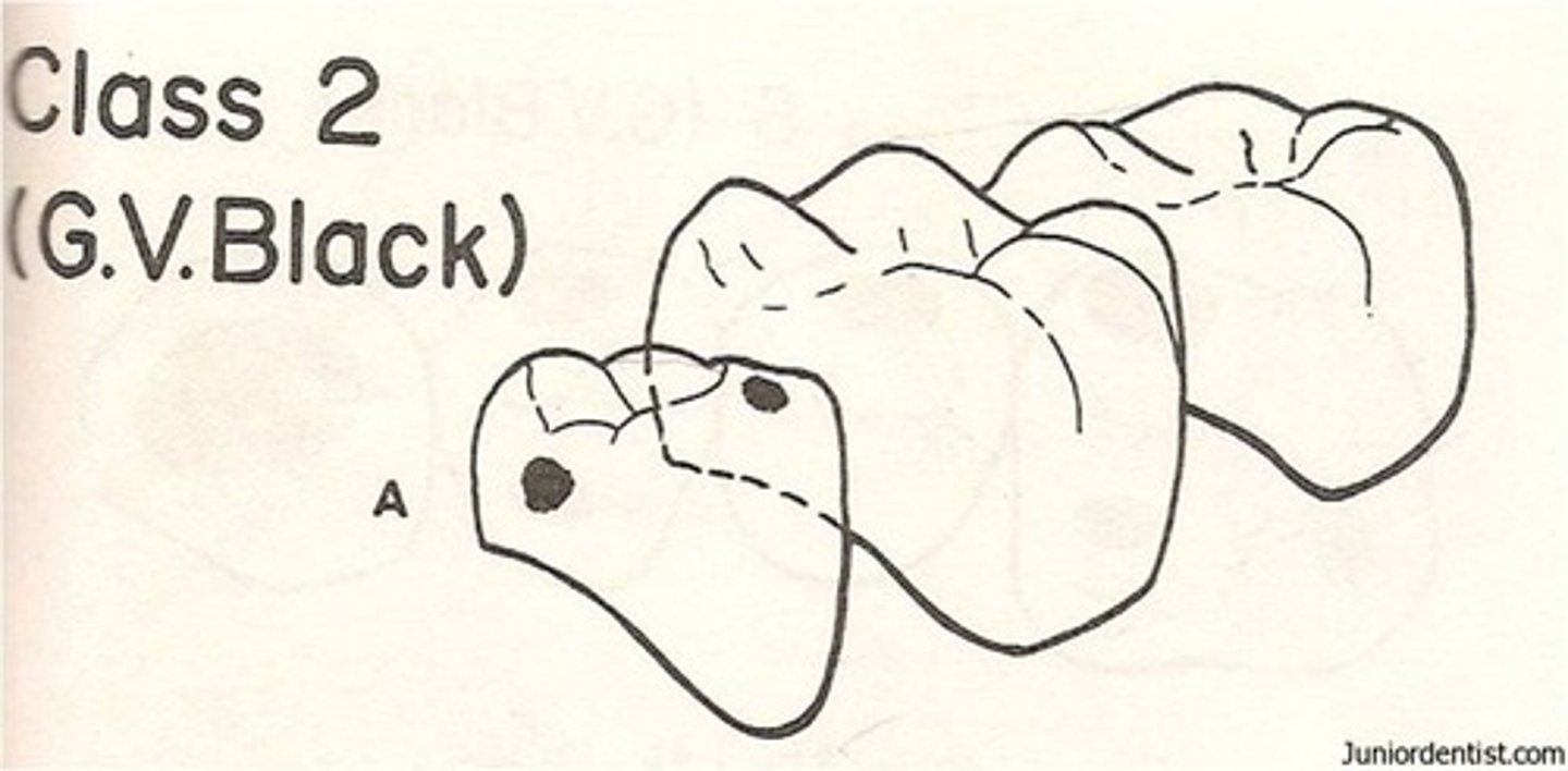<p>proximal, posterior teeth</p>