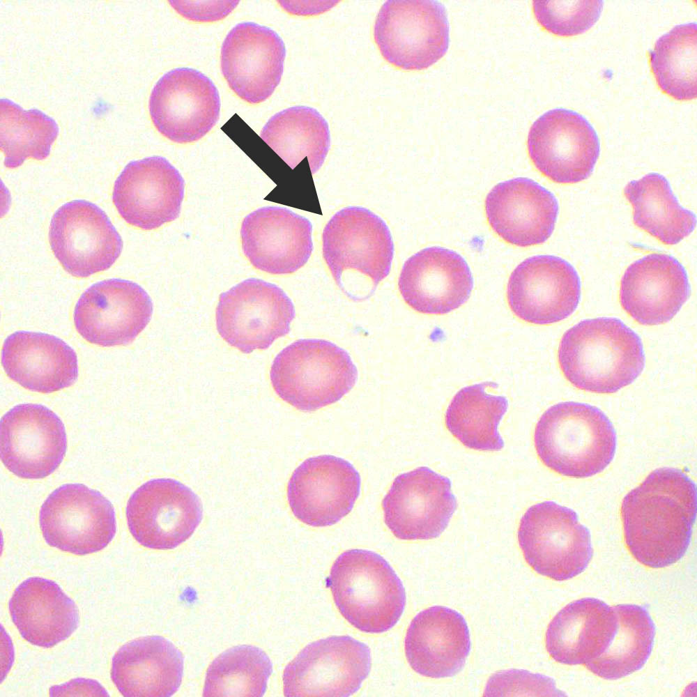 <p>What is the arrow pointing to?</p>