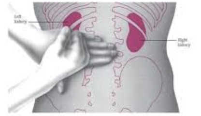 <ul><li><p>Which assessment is being performed for this patient?</p></li><li><p>What does it assess for?</p></li></ul><p></p>