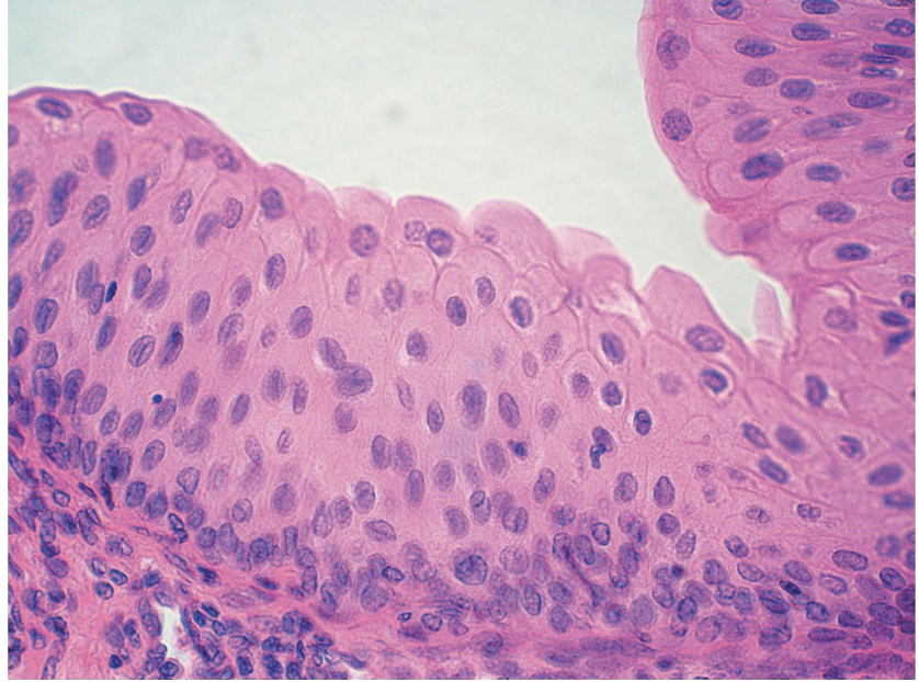 <ul><li><p>Urothelium</p></li></ul>