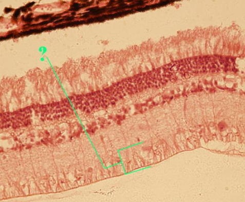 <p><span><span>Identify the indicated layer of the retina.</span></span></p>