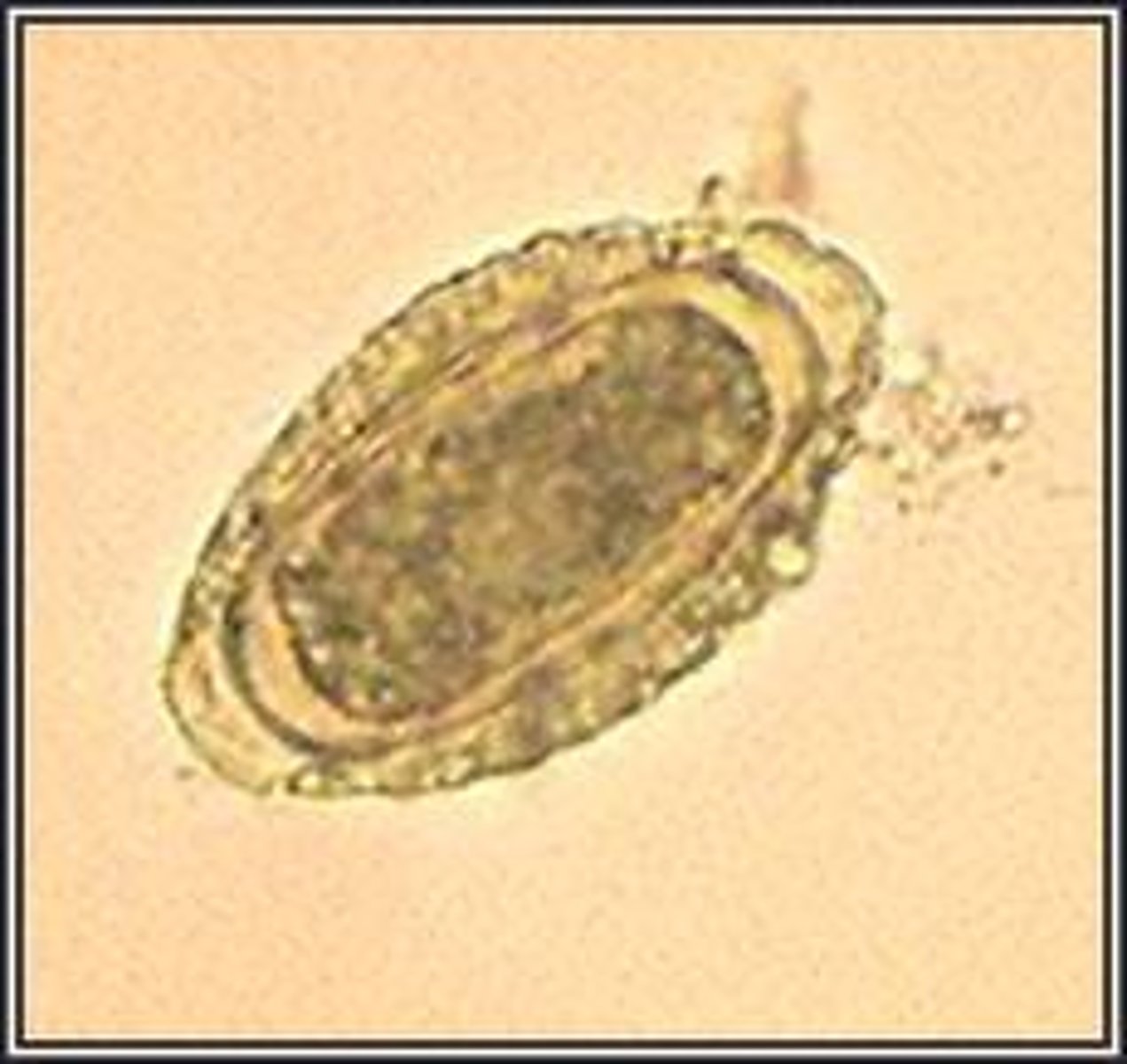 <p>kidney worm of dogs</p>