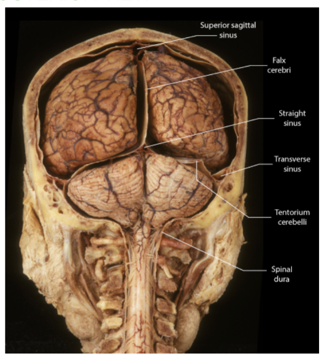 <p><strong>The dura mater </strong>extends inward to form 3 folds!</p><p><strong>1.Falx cerebri - </strong>between two cerebral hemispheres</p><p><strong>2. Falx cerebelli - </strong>between two cerebellum hemispheres.</p><p><strong>3. Tentorium cerebelli - </strong>like a <strong>tent</strong> over the cerebellum<strong>. Between cerebrum and cerebellum</strong></p>