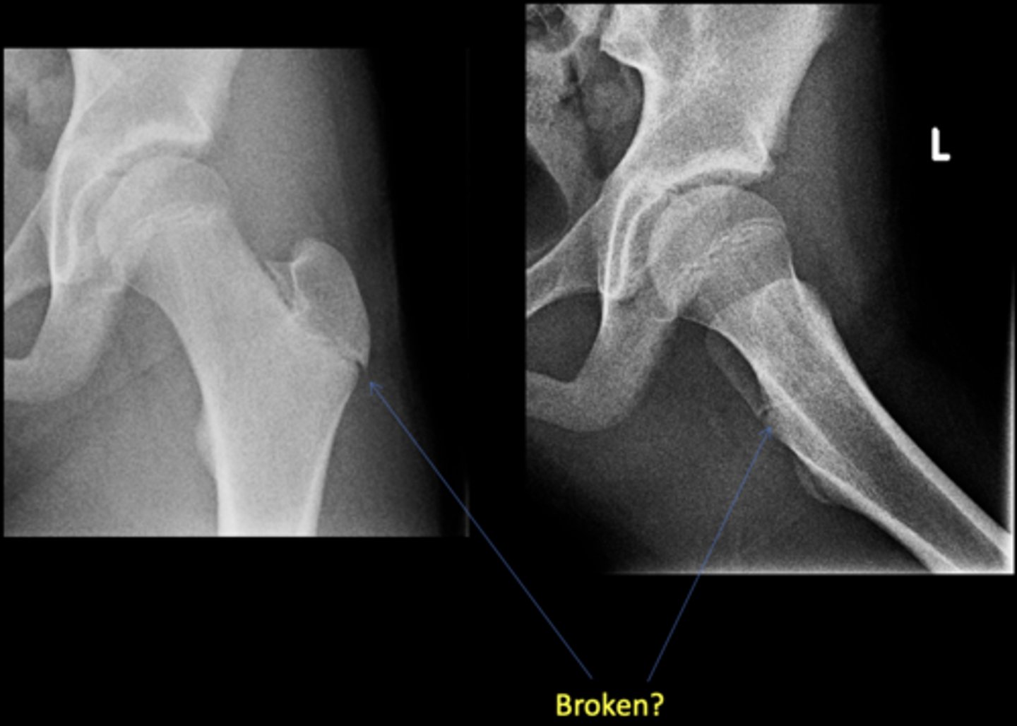 <p>Broken?</p>