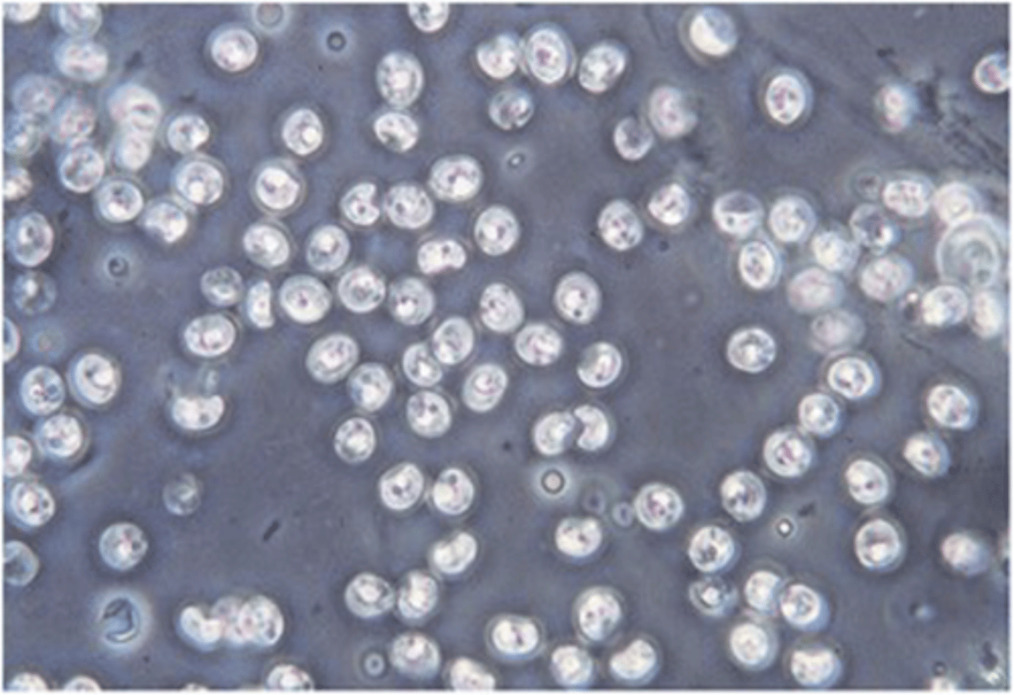 <p>This apicomplexan of dogs and cats produces extremely small oocysts. While seen on fecal</p><p>flotation, they are observed just under the coverslip rather than in the normal plane used for</p><p>other parasite oocysts and ova.</p>