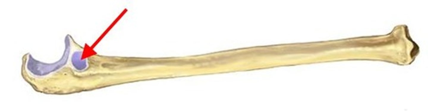 <p>ID indentation</p>