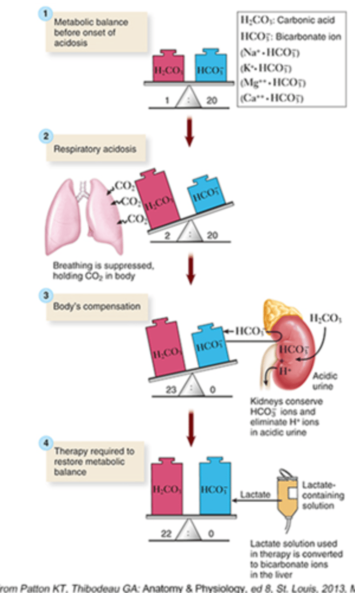<p>Excess CO2 in the blood d/t bradypnea</p><p>- CO2: Rise</p><p>- pH: Drops</p><p>How do the kidneys compensate?</p><p>- Hold on to the bicarb to make it more basic</p><p>- Get rid of hydrogen ions</p><p>- Urine is more acidic</p>