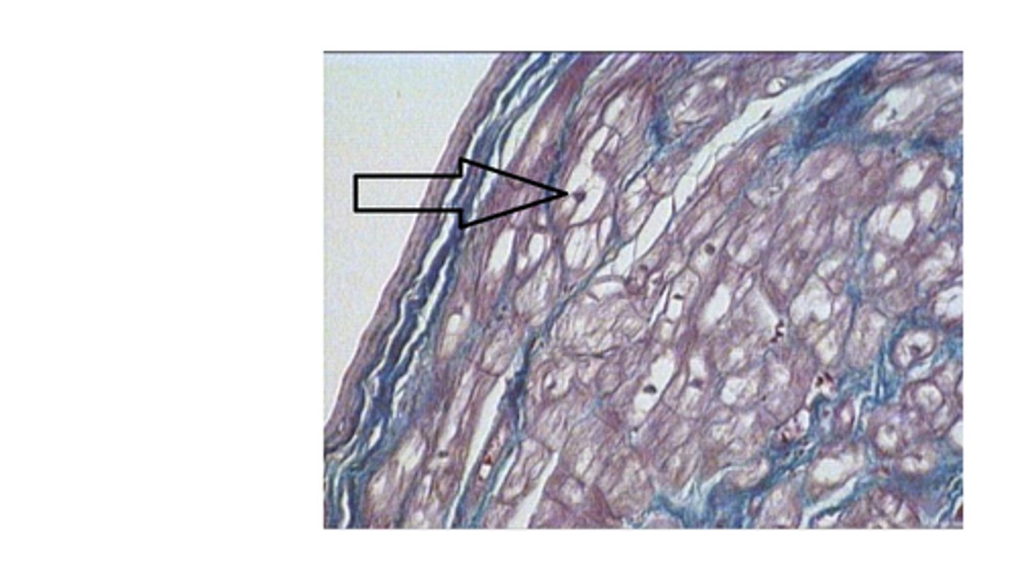 <p>Which of the following statements is not correct about the cell at the arrow?</p>