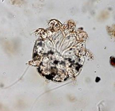 <p>What Parasite Is This?</p>