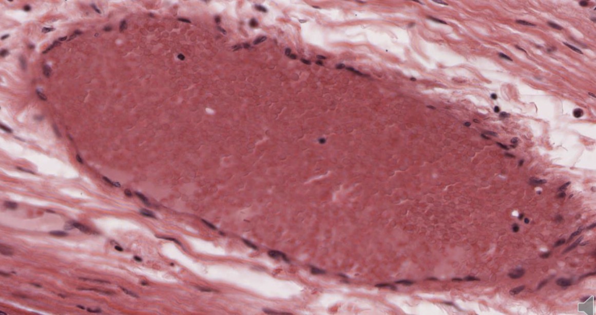 <p>Epitelio monoestratificado plano</p>