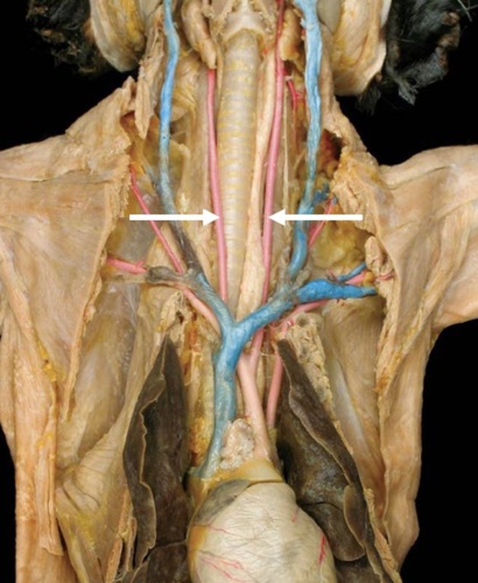 <p>What is this artery?</p>