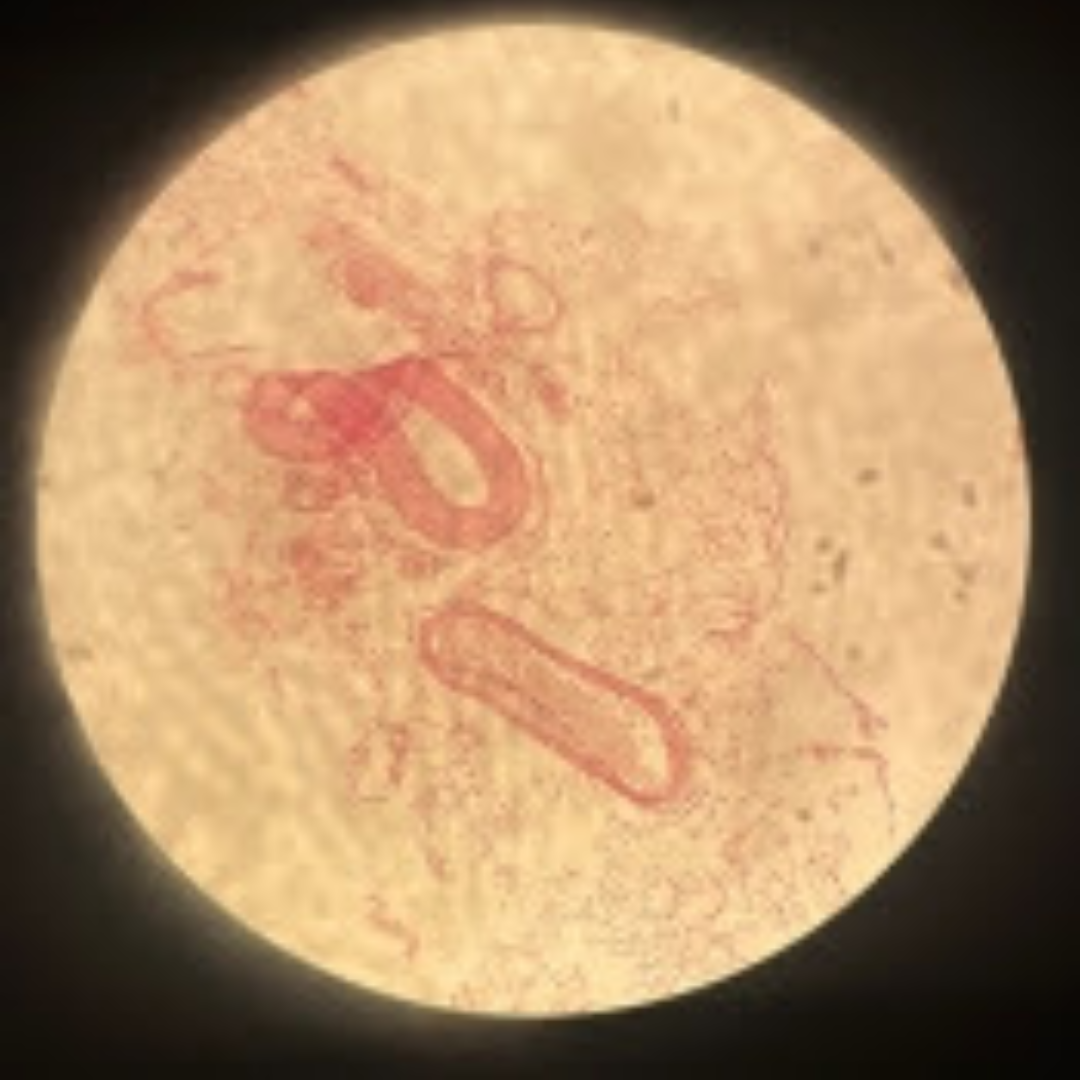 term image
