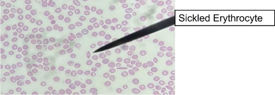 <p>What is the pointer showing&nbsp;</p>