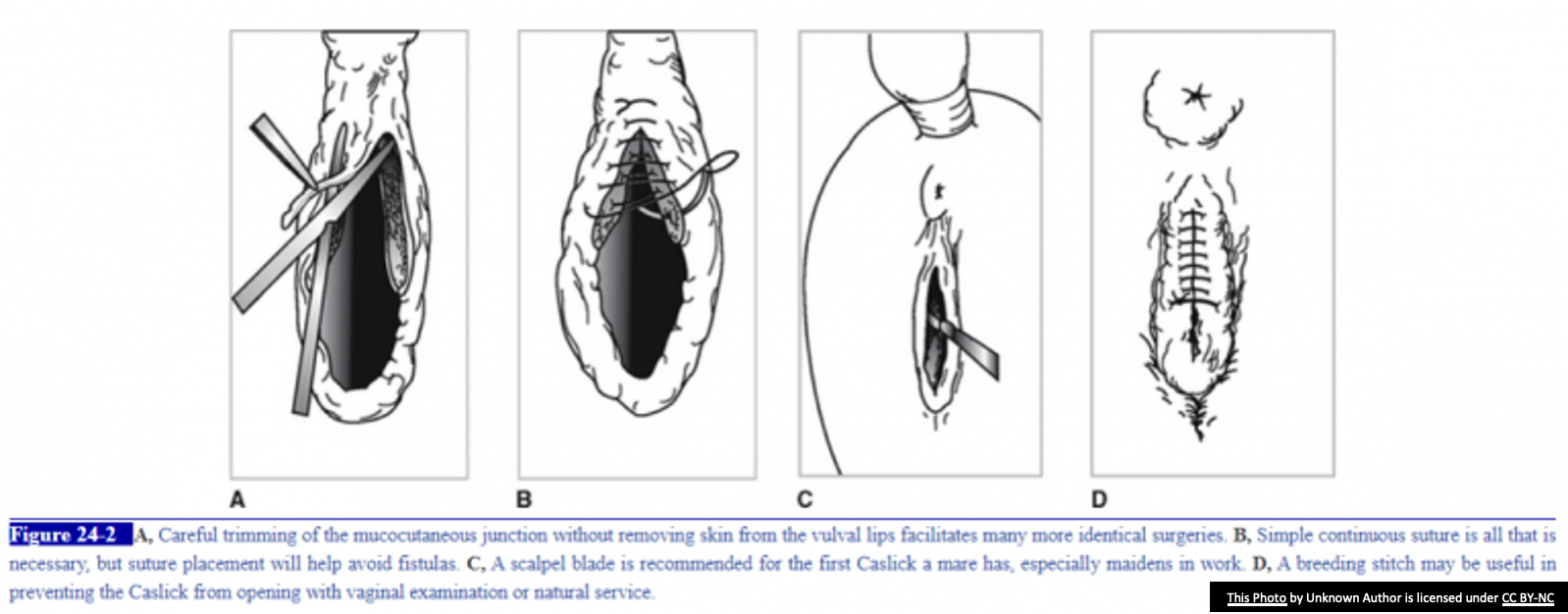 <ul><li><p>Procedure where the dorsal 2/3 of the vulva are sutured closed to prevent wind-sucking in mares.</p></li><li><p><span>Must be removed during breeding or prior to parturition</span></p></li></ul><p></p>