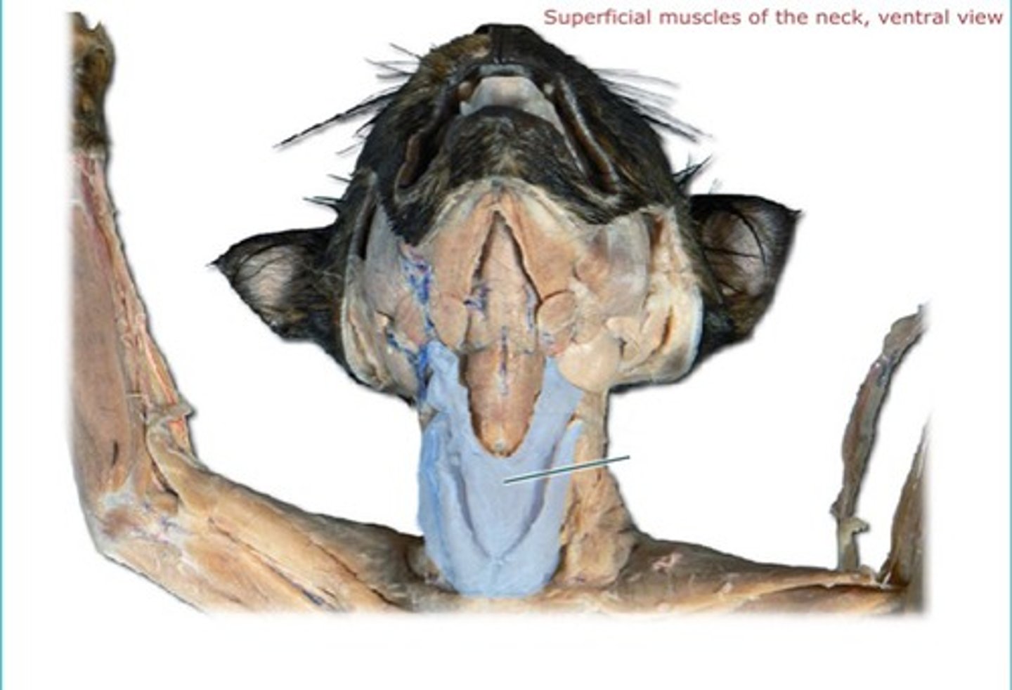 <p>name this muscle</p>