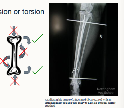 <p>what are intramedullary rods used for</p>