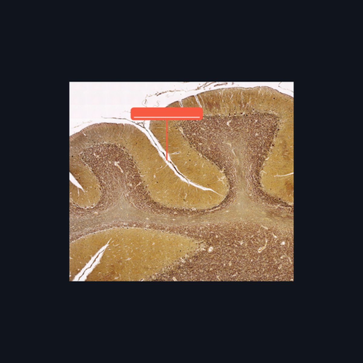 <p>The surface of the cerebellum exhibits transverse folds called the _____.</p>