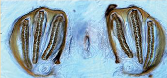 <p>This spiracle belongs to which fly larvae?</p>