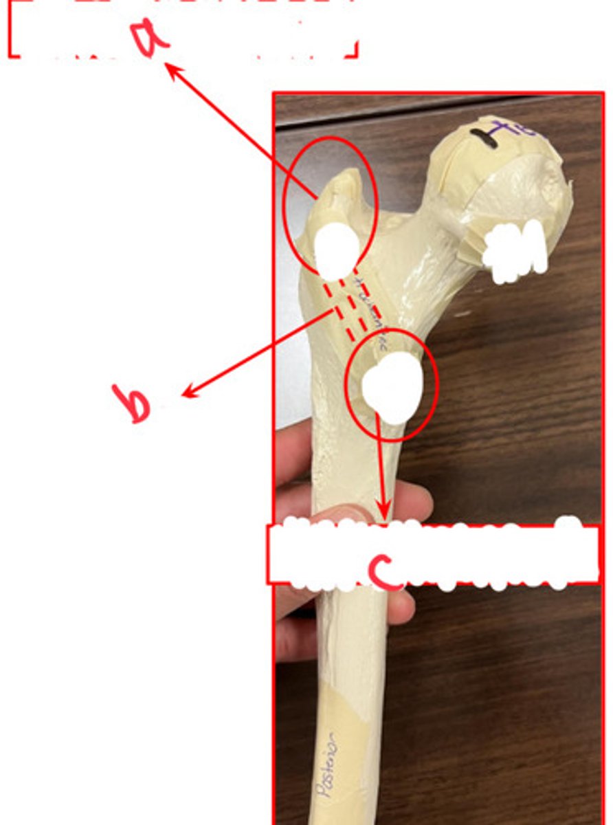 <p>what structure is labeled by a?</p>