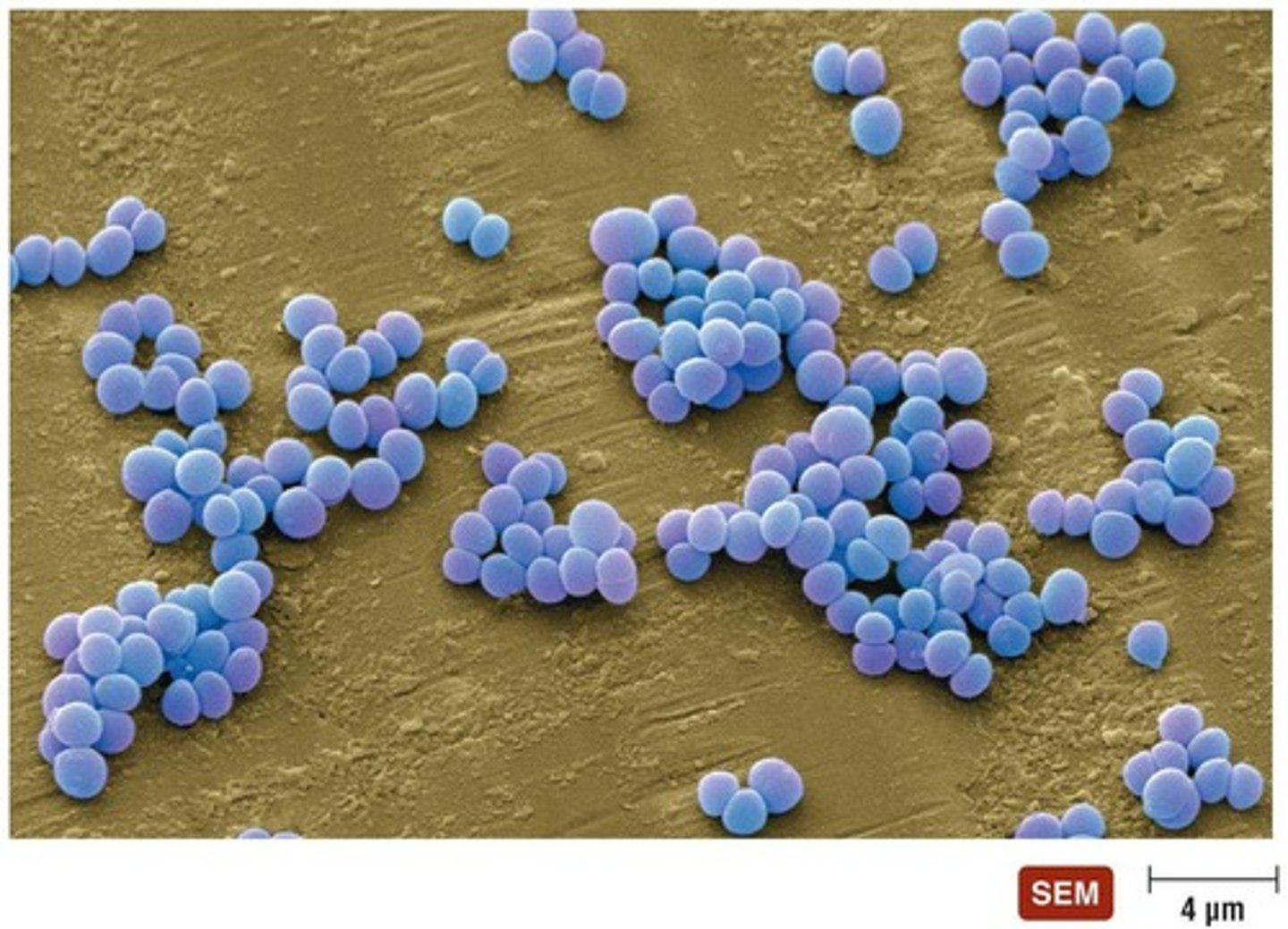<p>In grapelike clusters</p>