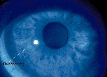 <p>What condition is this?</p>