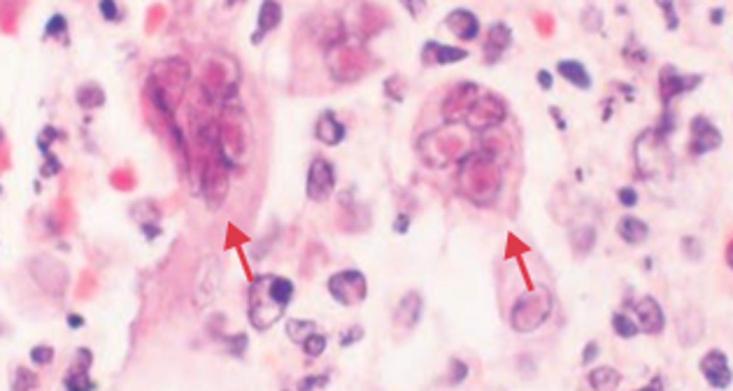 <p>more than one nucleus per cell</p>