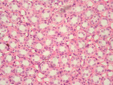 <p>Simple cuboidal epithelium</p>